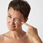 Como tirar manchas do rosto: Os melhores cremes e produtos para se livrar delas